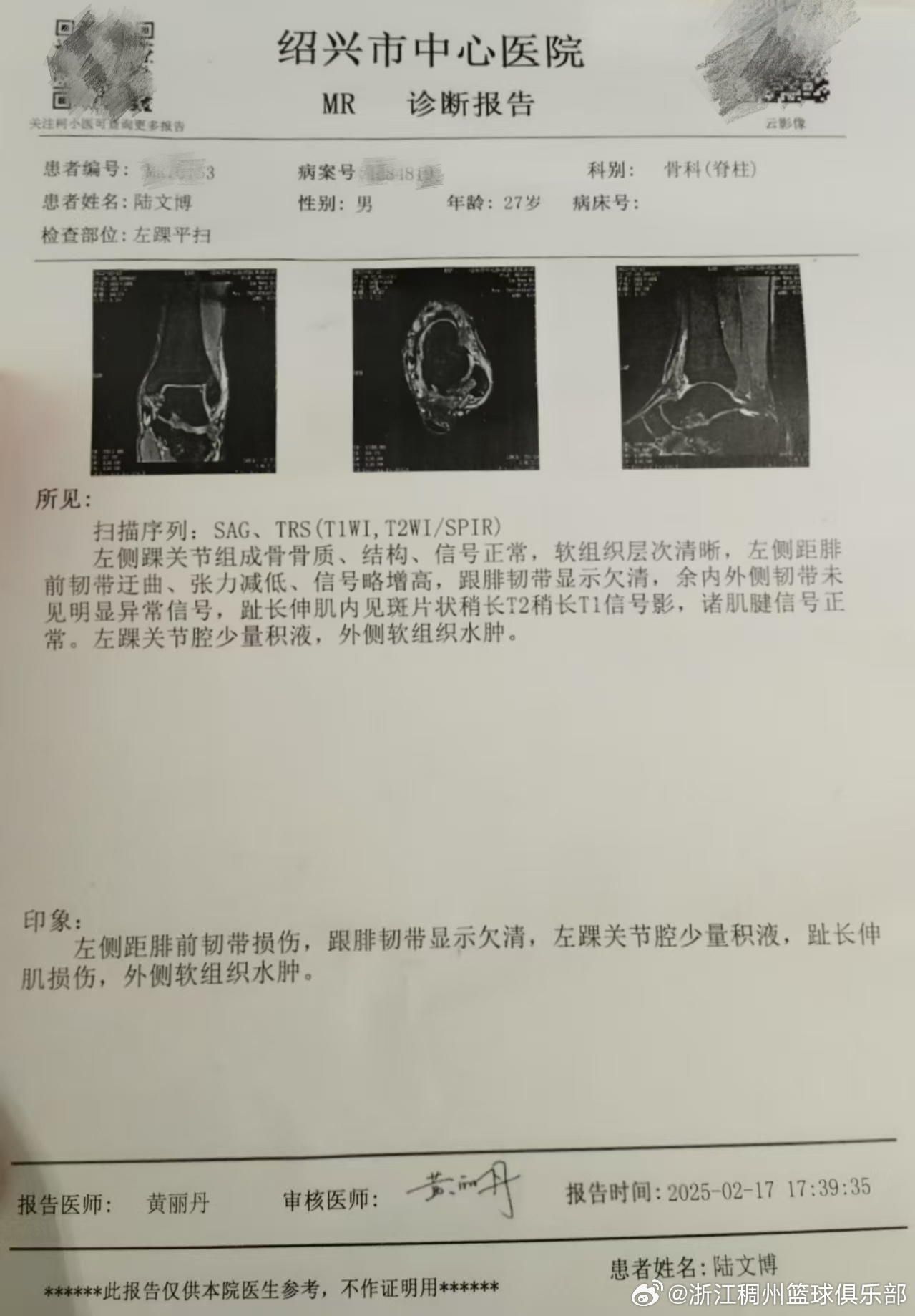 響很大